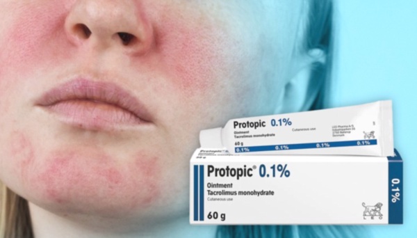 protopic